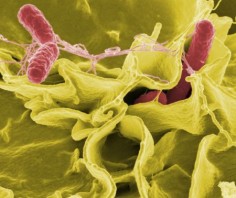 Salmonella © Rocky Mountain Laboratories, NIAID, NIH