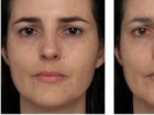 Porcheron A, Mauger E, Russell R (2013) Aspects of Facial Contrast Decrease with Age and Are Cues for Age Perception. PLoS ONE 8(3): e57985. doi:10.1371/journal.pone.0057985