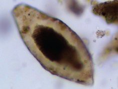 Schistosoma - Wpływ Schistosoma - Wpływ