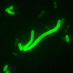 Yersinia pestis, pałeczki dżumy© CDC