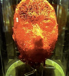 Układ krwionośny głowy© misterbisson