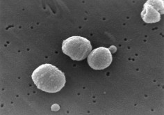 Streptococcus pneumoniae© CDC/Janice Carr