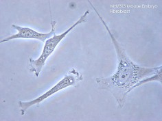 Mysie fibroblasty