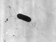 Listeria