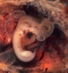 Siedmiotygodniowy ludzki embrion© Ed Uthman