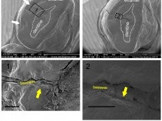 Bernardini F., Tuniz C., Coppa A., Mancini L., Dreossi D. et al. (2012)/PLoS One