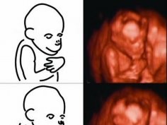 Current Biology, Sakai et al.: Fetal brain development in chimpanzees versus humans