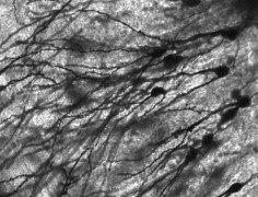 Neurony z ludzkiego hipokampa