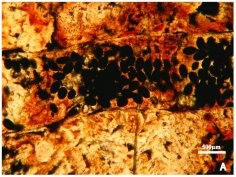 Credit: Paula C. Dentzien-Dias et al. Tapeworm Eggs in a 270 Million-Year-Old Shark Coprolite. PLoS ONE, 2013; 8 (1): e55007 DOI: 10.1371/journal.pone.0055007