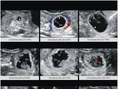 Drews et al. Scientific Reports 3, Article number: 1458, Ultrasonography of wallaby prenatal development shows that the climb to the pouch begins in utero, doi:10.1038/srep01458