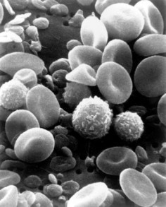 Krew pod skanningowym mikroskopem elektronowym© National Cancer Institute, Bruce Wetzel