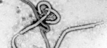 Wirus Ebola© Centers for Disease Control and Prevention