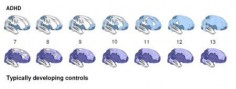 Dojrzewanie mózgu; jaśniejsze obszary są cieńsze, ciemniejsze - grubsze