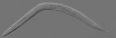 Caenorhabditis elegans© Zeynep F. Altun, Editor of www.wormatlas.org