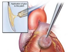 Karp et al., Sci. Transl. Med. DOI: 10.1126/scitranslmed.3006557