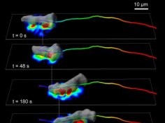 Image courtesy of the Journal of Cell Biology and ©2014 Bastounis et al.