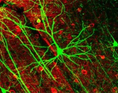 Neurony w korze mózgowej myszylicencja: Creative Commons