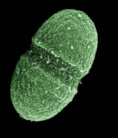 Enterococcus faecalis, jedna z bakterii, które może pomóc w zrozumieniu alergii© US DoA
