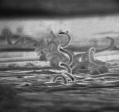 Treponema pallidum - to ona wywołuje syfilis