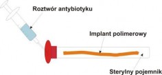 Schemat modyfikacji gotowego implantu