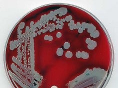 Staphylococcus aureus