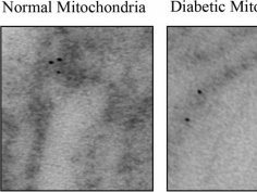 Partha Banerjee/Johns Hopkins Medicine