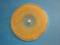 Płytka z bakteriami (pomarańczowe), w środku krążek nasączony rhodostreptomycyną. Wokół krążka bakterie zginęły© Kazuhiko Kurosawa, MIT