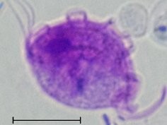 Escalante et al., 2016, DOI: 10.1084/jem.20161776