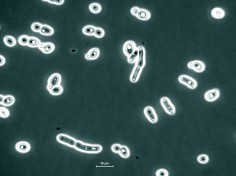 Drożdże piekarskie (Saccharomyces cerevisiae)