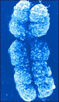 Chromosom X