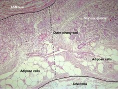 European Respiratory Journal