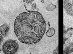 Alain R. Thierry/Inserm