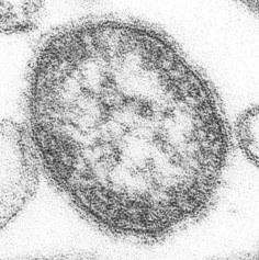 Wirus odry (Morbillivirus)