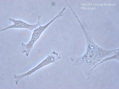 3T3 - linia komórkowa mysich fibroblastów