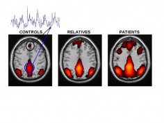 Susan Whitfield-Gabrieli; McGovern Institute for Brain Research, MIT