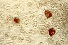 Bakterie Chlamydia trachomatis (brązowe punkty)