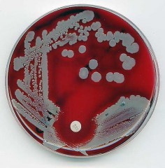 Staphylococcus aureus