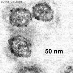 Wirus zapalenia wątroby typu C (HCV)