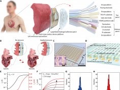 Jae Chul Hwang et al. „In situ diagnosis and simultaneous treatment of cardiac diseases using a single-device platform”, Sci Adv vol 8, 37 (2022)