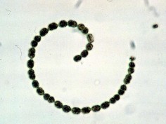 Anabaena flosaquae