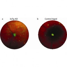 Siatkówka oka u zwierząt cierpiących na chorobę Alzheimera (lewa) i wolnych od niej (prawa strona obrazu)