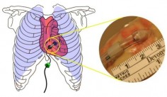 HeartLander© Carnegie Mellon University