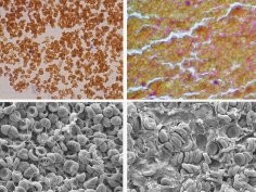 Alina D. Peshkova et al., Blood Adv (2025) 9 (14): 3418–3428
