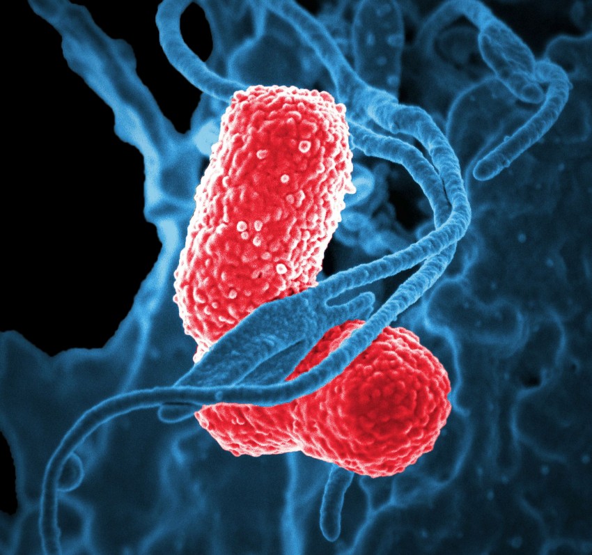 Co łączy raka jelita grubego z wirusem ukrytym w bakterii?
