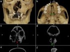 Sun, X., et al., International Journal of Osteoarchaeology36, no. 2: 433–445. https://doi.org/10.1002/oa.70095.
