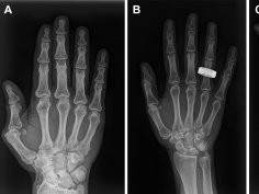 Radiological Society of North America (RSNA)